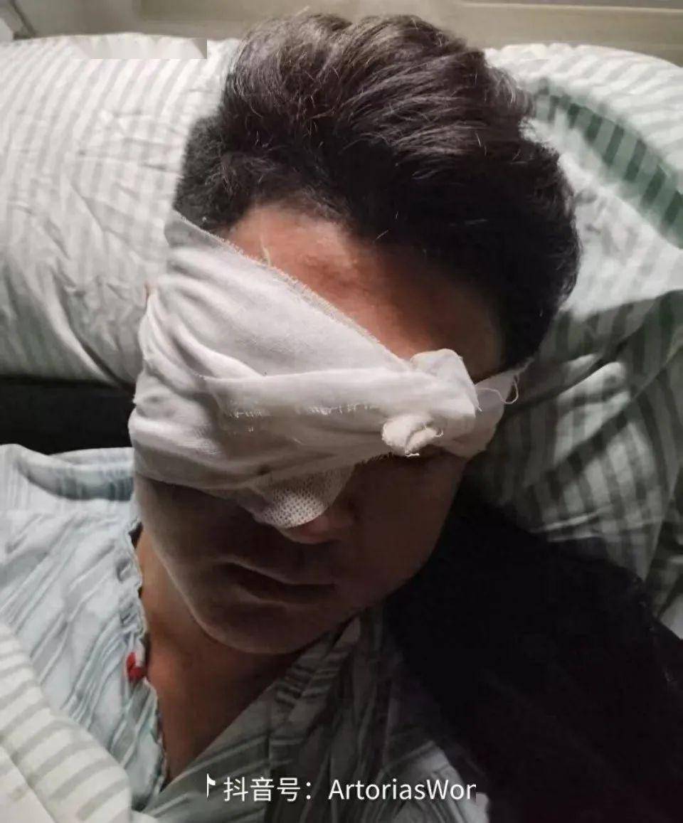 男子酒后点燃礼花被炸身亡；另一男子被烟花爆竹击中致右眼球摘除